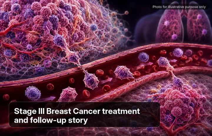 Kim, who was diagnosed with Stage III Breast Cancer