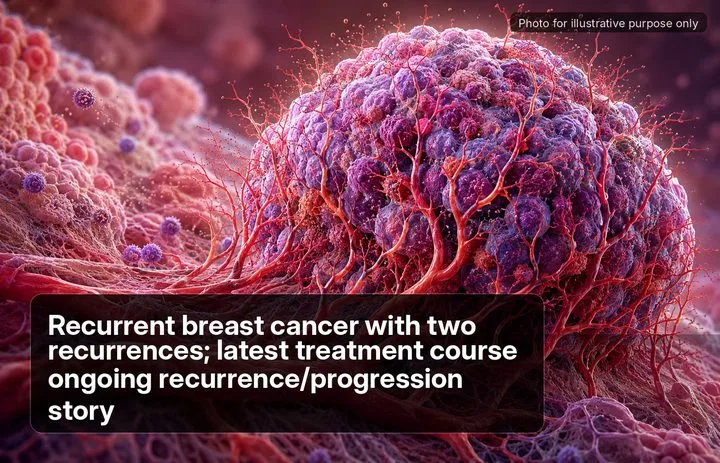 A patient, who was diagnosed with Breast Cancer