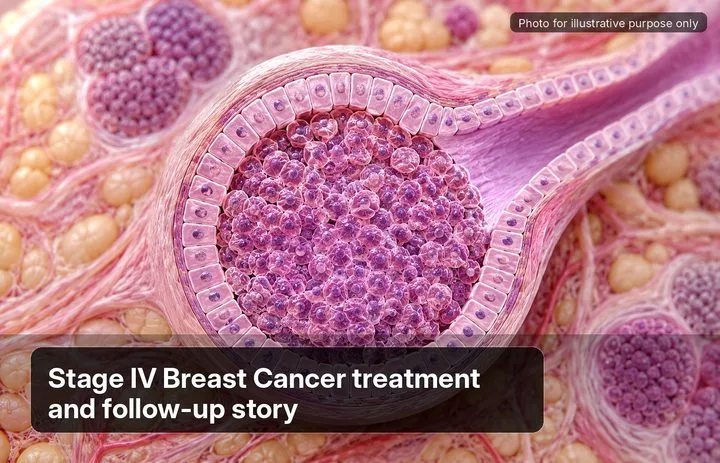 A patient, who was diagnosed with Breast Cancer