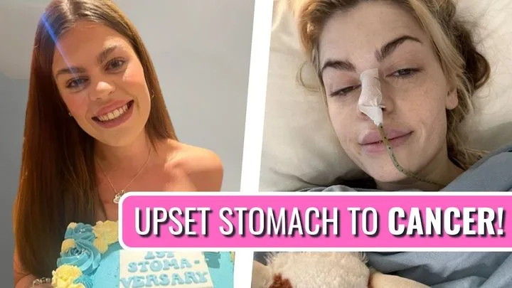 Chloe, who was diagnosed with Stage III Colorectal Cancer