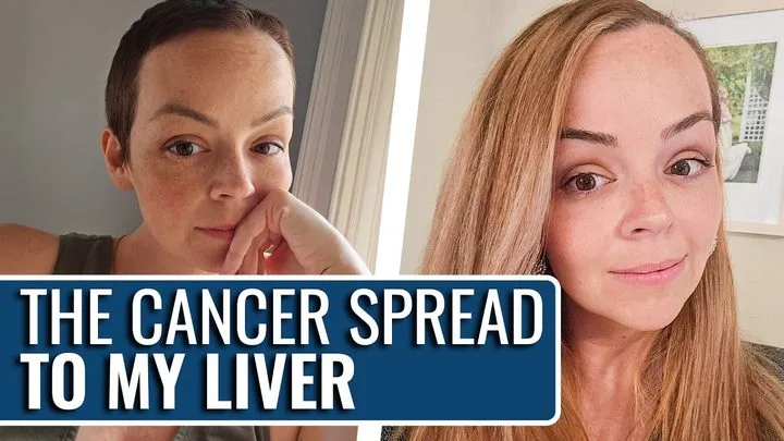 Heather, who was diagnosed with Stage IV Colorectal Cancer