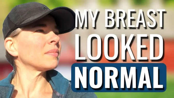 Kathleen, who was diagnosed with Stage 0 Invasive Lobular Carcinoma